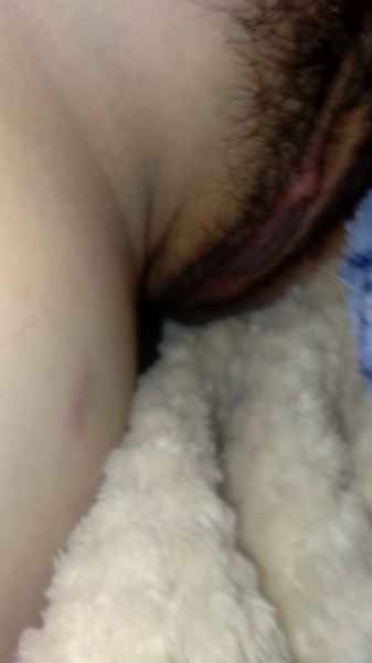 รูปโป๊