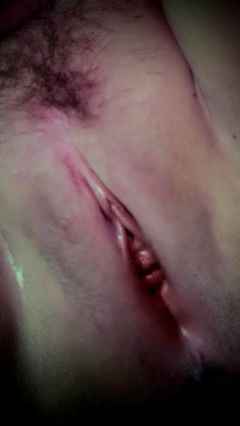 รูปโป๊