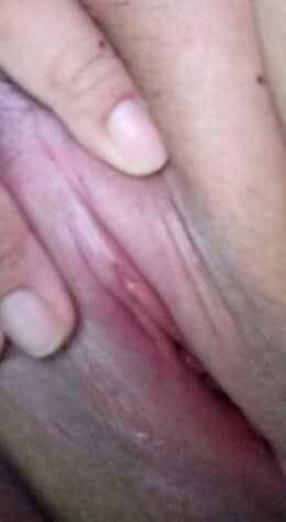 รูปโป๊