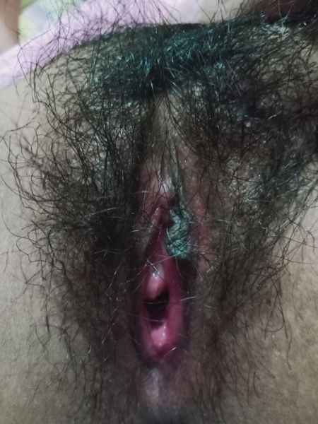รูปโป๊
