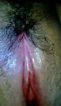 รูปโป๊