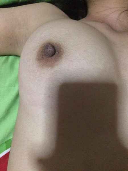 รูปโป๊