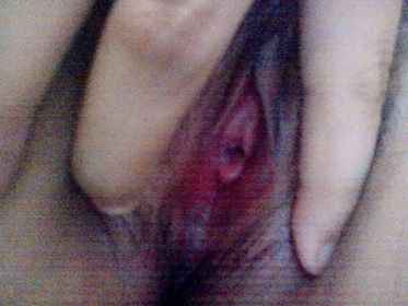 รูปโป๊