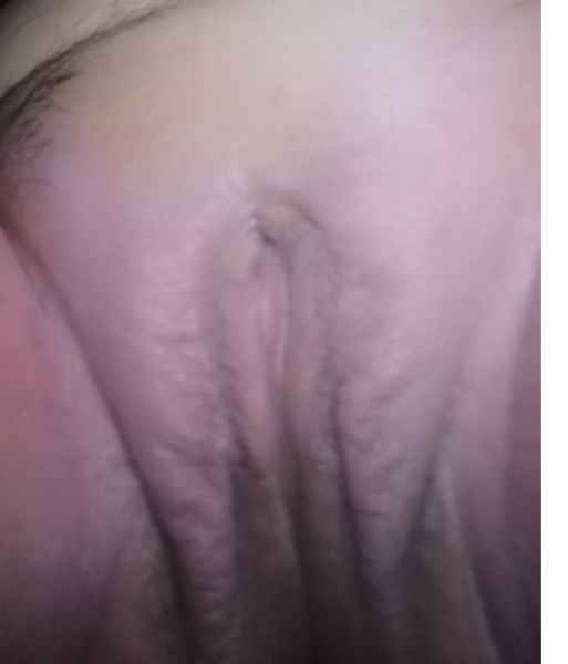 รูปโป๊