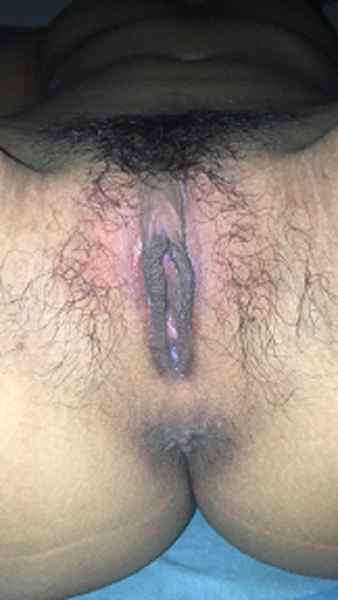รูปโป๊