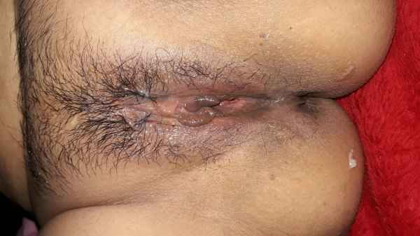 รูปโป๊