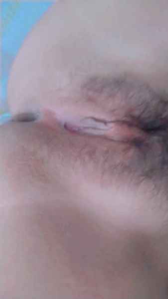 รูปโป๊