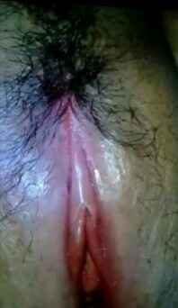 รูปโป๊