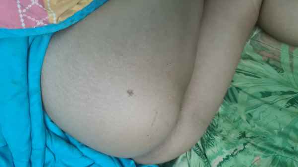 รูปโป๊