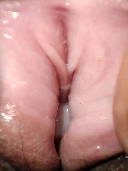 รูปโป๊