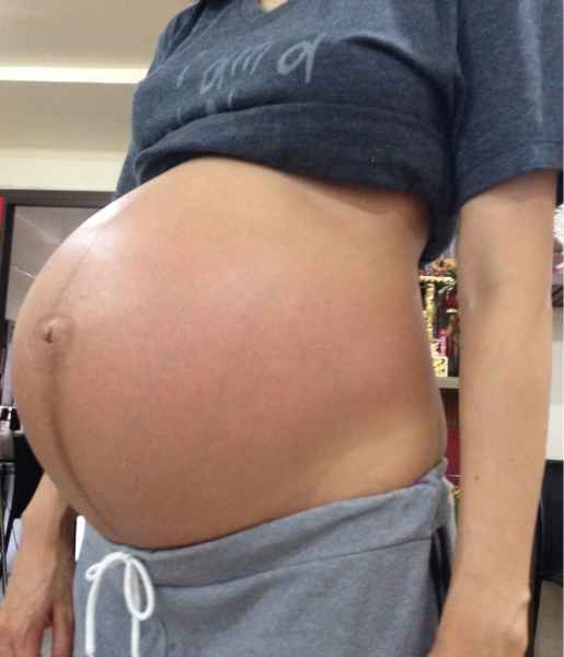 รูปโป๊