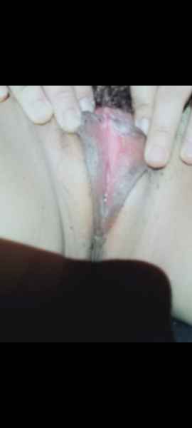 รูปโป๊