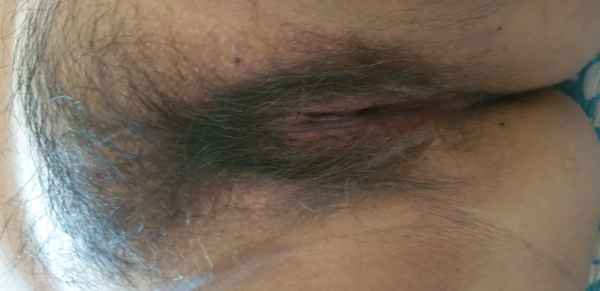 รูปโป๊
