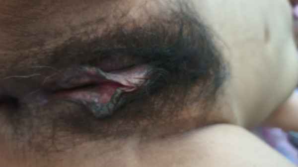 รูปโป๊