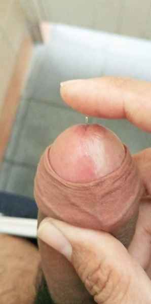 รูปโป๊