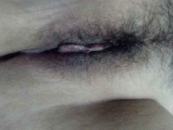 รูปโป๊