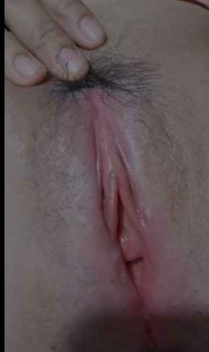 รูปโป๊
