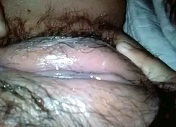 รูปโป๊
