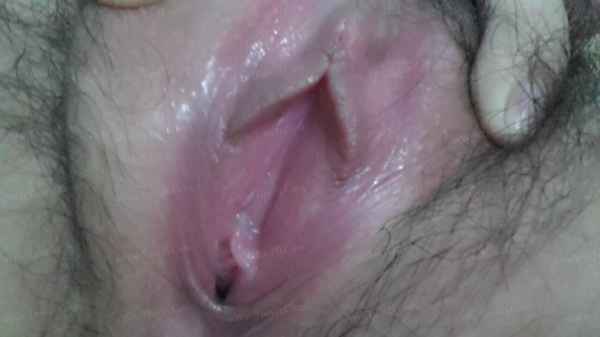 รูปโป๊