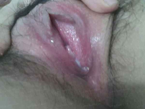 รูปโป๊