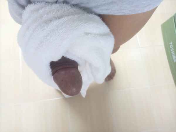 รูปโป๊