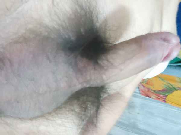 รูปโป๊