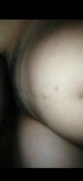 รูปโป๊