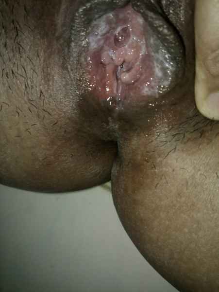 รูปโป๊