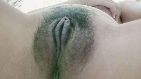 รูปโป๊