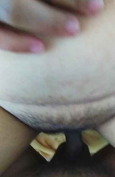 รูปโป๊