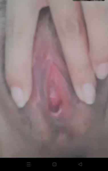 รูปโป๊