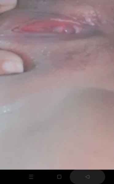 รูปโป๊