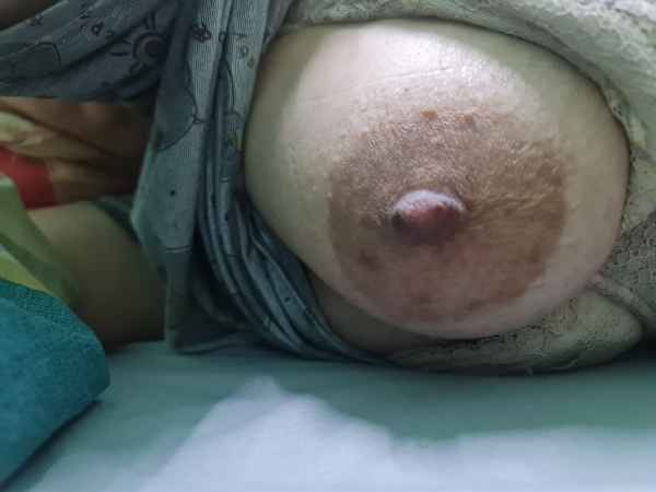 รูปโป๊