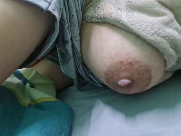 รูปโป๊