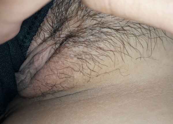 รูปโป๊