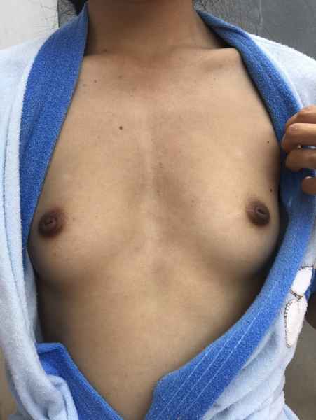 รูปโป๊