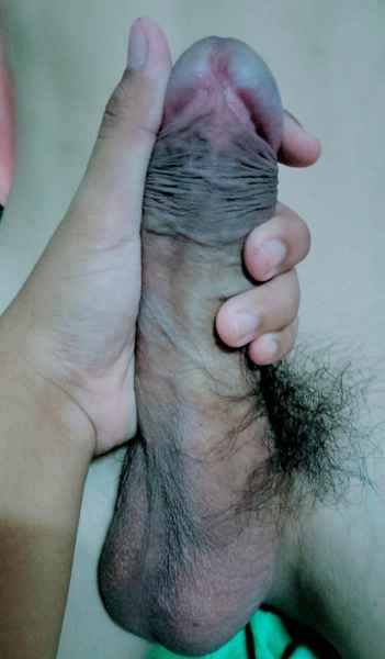 รูปโป๊