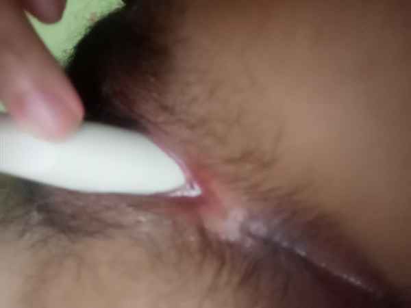รูปโป๊