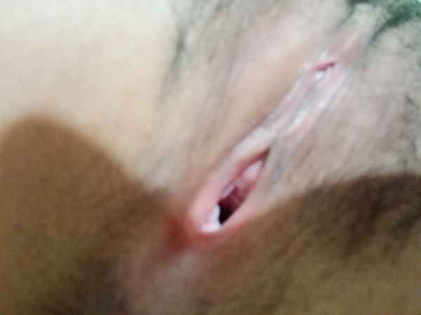 รูปโป๊