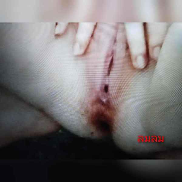 รูปโป๊