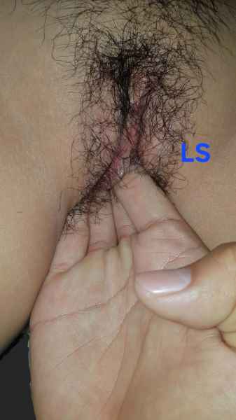 รูปโป๊