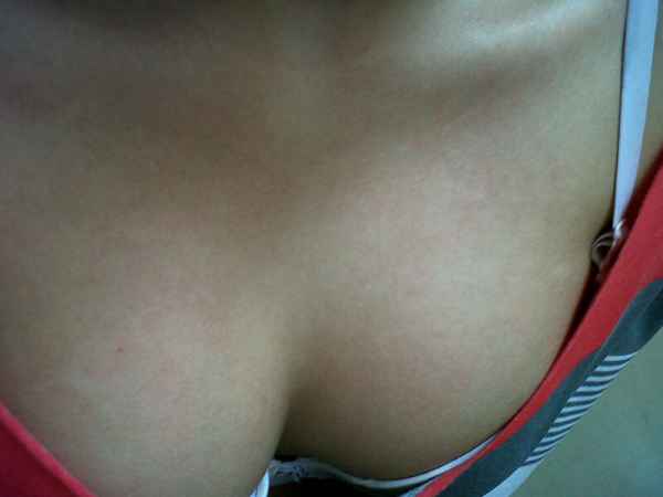 รูปโป๊