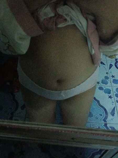 รูปโป๊